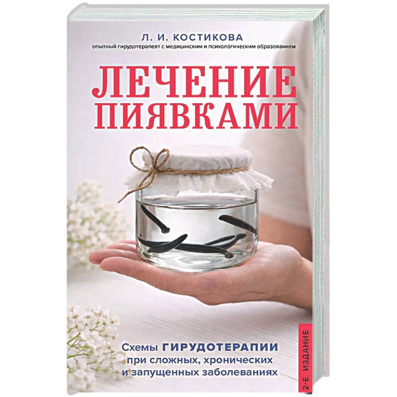 Лечение пиявками. Схемы гирудотерапии при сложных, хронических и запущенных заболеваниях
