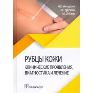 Рубцы кожи. Клинические проявления,диагностика и лечение