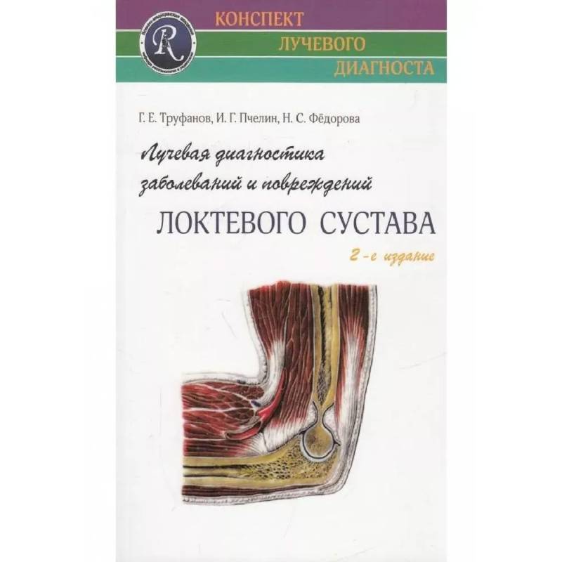 Лучевая диагностика заболеваний и повреждений локтевого сустава Лучевая диагностика заболеваний и повреждений локтевого сустава