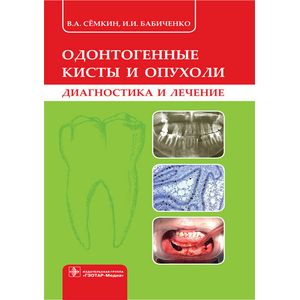 Одонтогенные кисты и опухоли. Диагностика и лечение