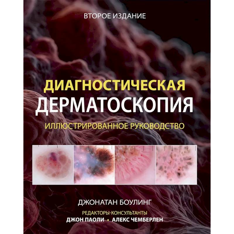 Диагностическая дерматоскопия: иллюстрированное руководство