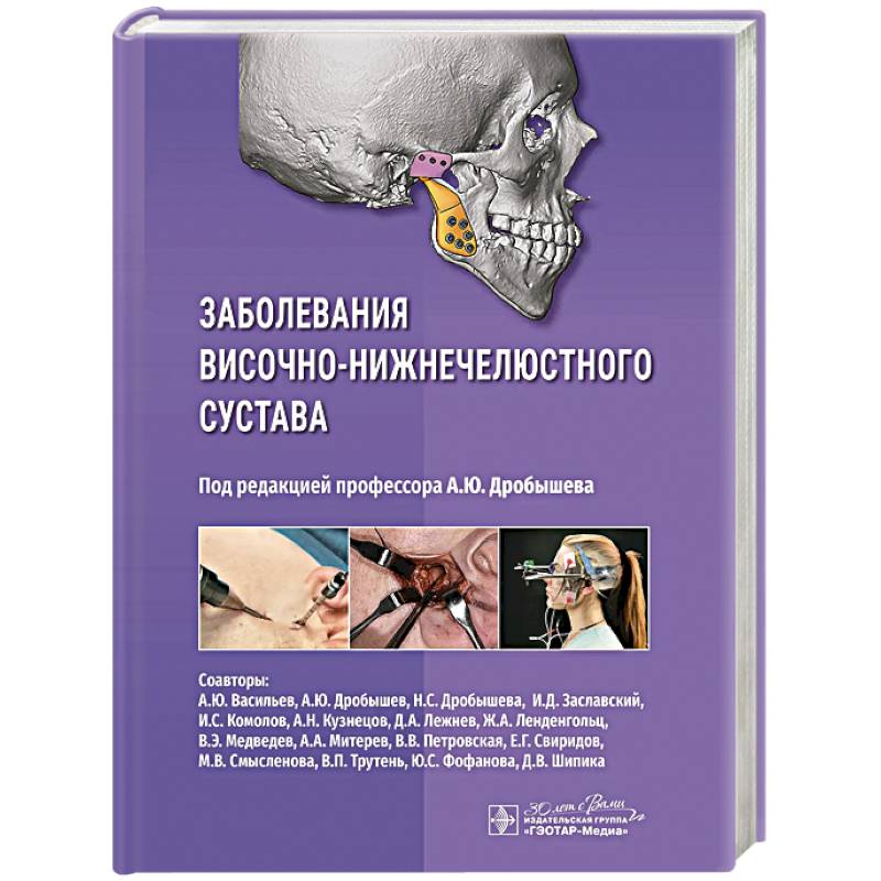 Заболевания височно-нижнечелюстного сустава