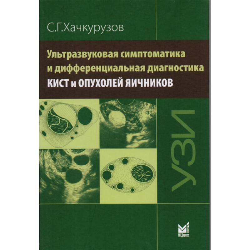Ультразвуковая симптоматика и дифференциальная диагностика кист и опухолей яичников Ультразвуковая симптоматика и дифференциальная диагностика кист и опухолей яичников