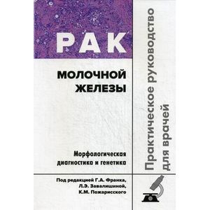 Рак молочной железы. Практическое руководство для врачей