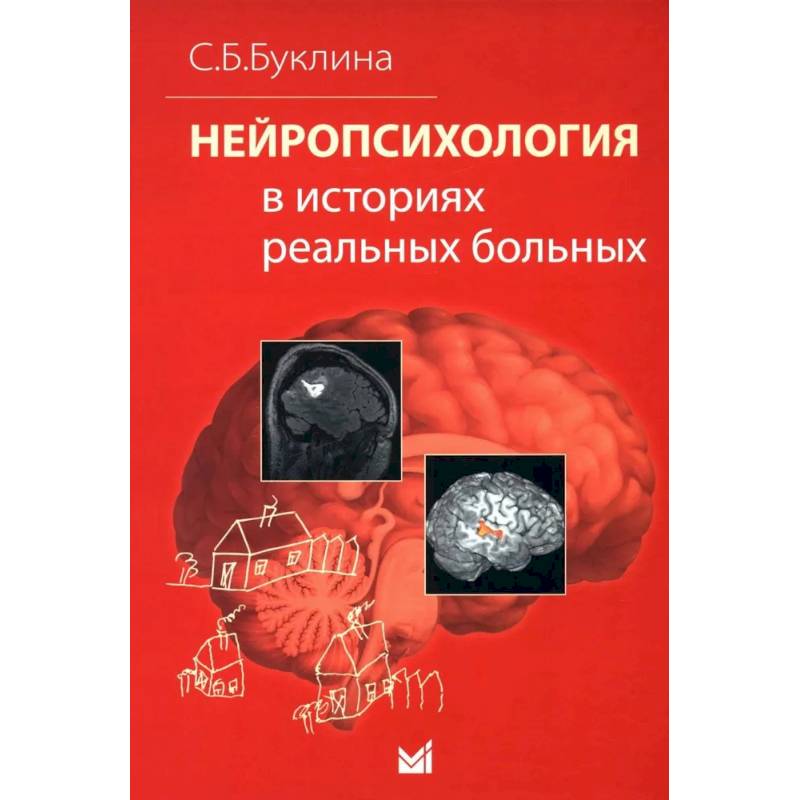 Нейропсихология в историях реальных больных