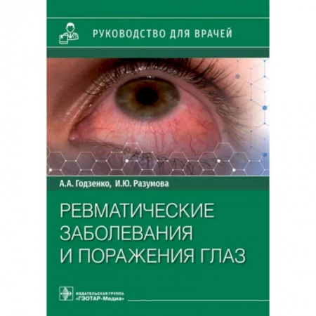 Книги, книга Ревматические заболевания и поражения глаз купить по скидке