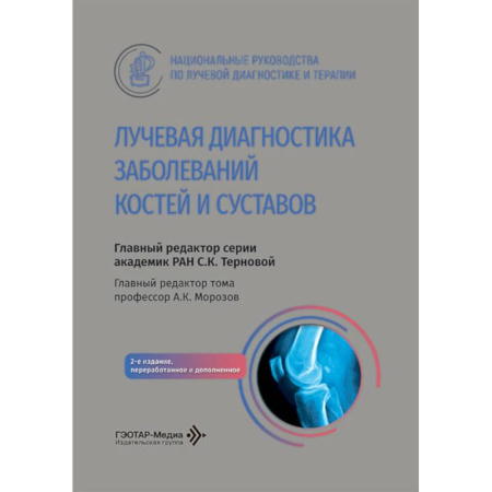 Медицинские энциклопедии и справочники, книга Лучевая диагностика заболеваний костей и суставов. Национальное руководство купить по скидке