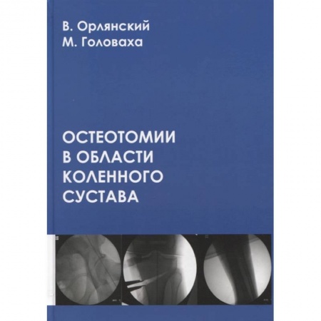 Хирургия. Ортопедия, книга Остеотомии в области коленного сустава купить по скидке