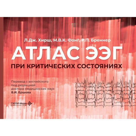 Кардиология, книга Атлас ЭЭГ при критических состояниях купить по скидке