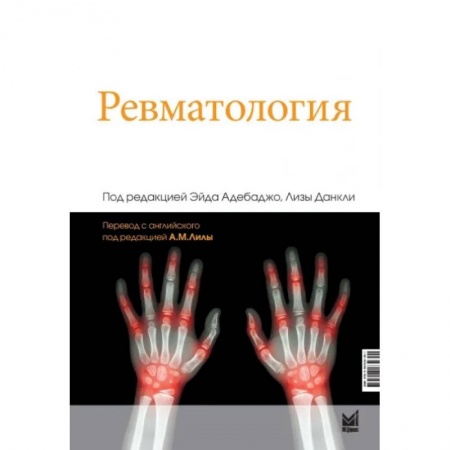 Хирургия. Ортопедия, книга Ревматология купить по скидке