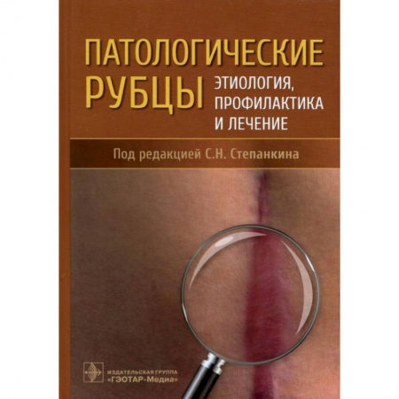 Хирургия. Ортопедия, книга Патологические рубцы. Этиология, профилактика и лечение купить по скидке