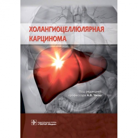 Онкология, книга Холангиоцеллюлярная карцинома купить по скидке