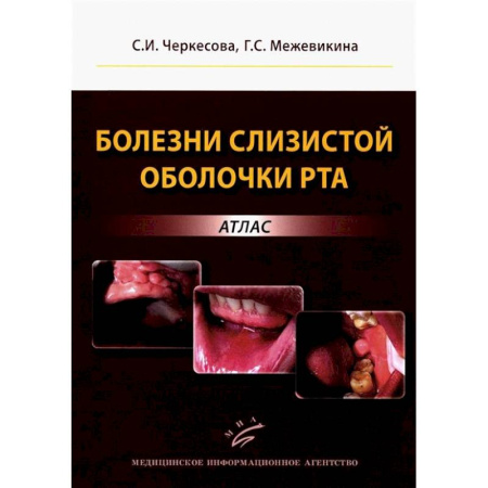 Другие виды специальной медицины, книга Болезни слизистой оболочки рта: атлас купить по скидке