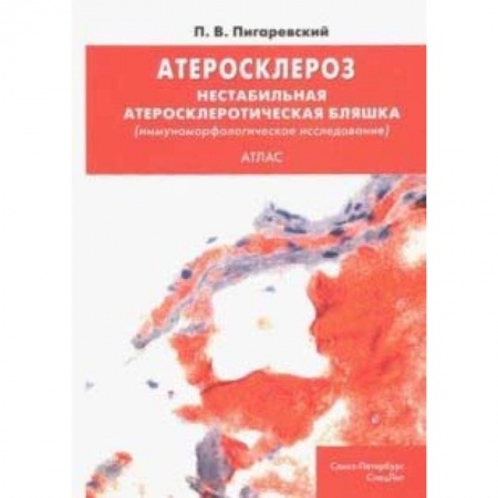 Кардиология, книга Атеросклероз. Нестабильная атеросклеротическая бляшка (иммуноморфологическое исследование). Атлас купить по скидке