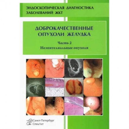 Онкология, книга Доброкачественные опухоли желудка. Неэпителиальные  опухоли. Часть 2 купить по скидке