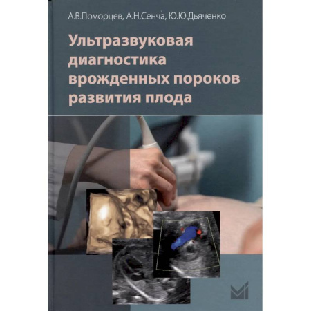Диагностика. Методы и виды, книга Ультразвуковая диагностика врожденных пороков развития плода купить по скидке