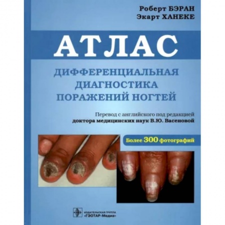 Другие виды специальной медицины, книга Дифференциальная диагностика поражен ногтей. Атлас купить по скидке
