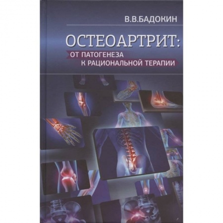 Внутренние болезни. Диагностика, книга Остеоартрит: от патогенеза к рациональной терапии купить по скидке
