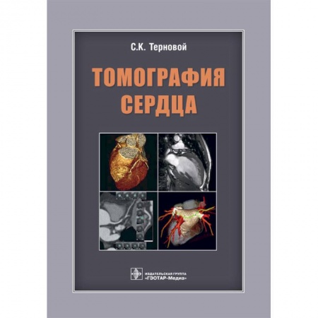 Кардиология, книга Томография сердца. Руководство для врачей купить по скидке