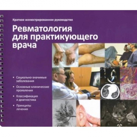 Внутренние болезни. Диагностика, книга Краткое иллюстрированное руководство «Ревматология для практикующего врача» купить по скидке