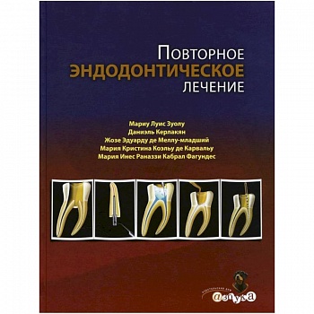 Повторное эндодонтическое лечение