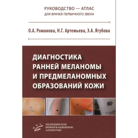 Диагностика. Терапии, книга Диагностика ранней меланомы и предмеланомных образований кожи: Руководство - атлас для врачей первичного звена купить по скидке