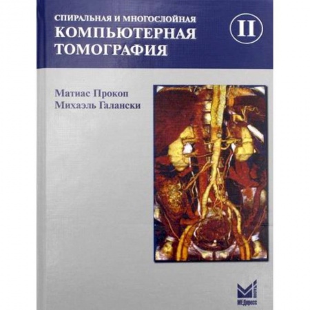 УЗИ. ЭКГ. Томография. Рентген, книга Спиральная и многослойная компьютерная томография купить по скидке