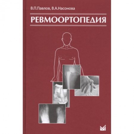 Хирургия. Ортопедия, книга Ревмоортопедия купить по скидке