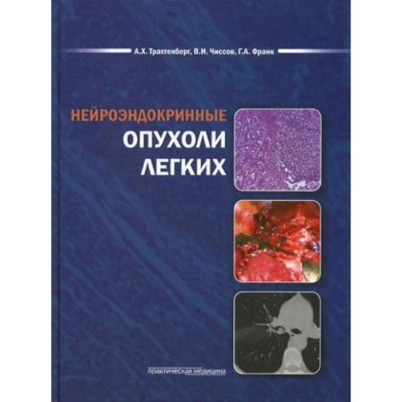 Онкология, книга Нейроэндокринные опухоли легких купить по скидке
