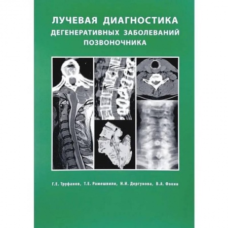 Другие виды специальной медицины, книга Лучевая диагностика  дегенеративных заболеваний позвоночника купить по скидке