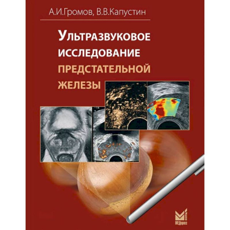 УЗИ. ЭКГ. Томография. Рентген, книга Ультразвуковое исследование предстательной железы купить по скидке