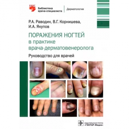 Кожные и венерические болезни, книга Поражения ногтей в практике врача-дерматовенеролога. Руководство для врачей купить по скидке