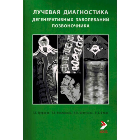 Диагностика. Методы и виды, книга Лучевая диагностика дегенеративных заболеваний позвоночника купить по скидке
