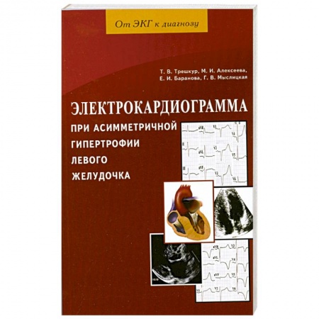 Книги, книга Электрокардиограмма при асимметричной гипертрофии левого желудочка купить по скидке