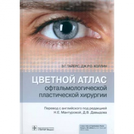 Офтальмология, книга Цветной атлас офтальмологической пластической хирургии купить по скидке