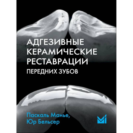 Стоматология, книга Адгезивные керамические реставрации передних зубов купить по скидке