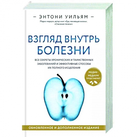 Популярная и нетрадиционная медицина, книга Взгляд внутрь болезни. Все секреты хронических и таинственных заболеваний купить по скидке